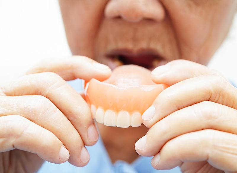 入れ歯